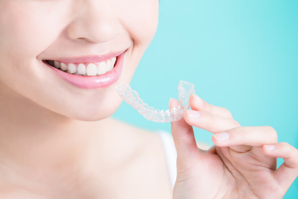 Invisalign Sydney